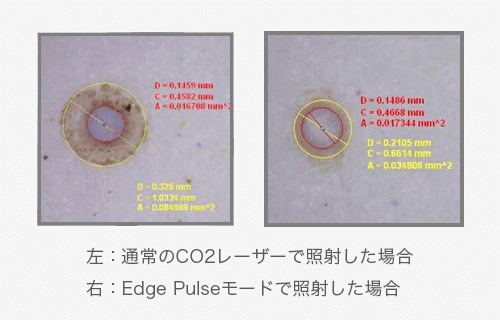 レーザー照射時の皮膚へのダメージ