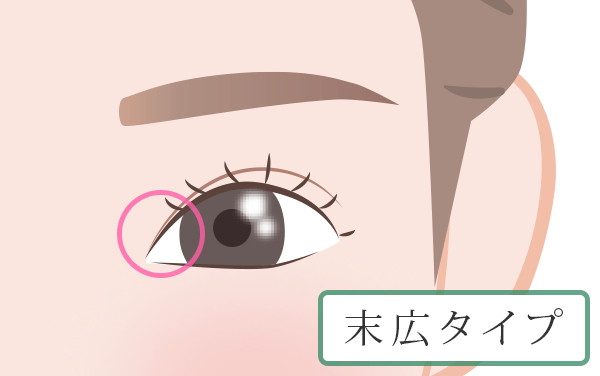 日本人に多い、すっきりと自然な形の二重