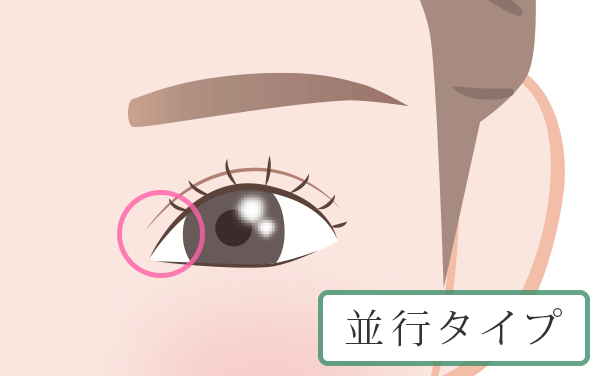 幅がほぼ一定な形の二重