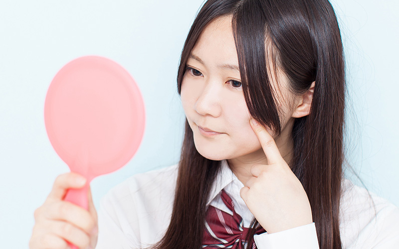 10代の方におすすめのローズマリークリニックのニキビ治療
